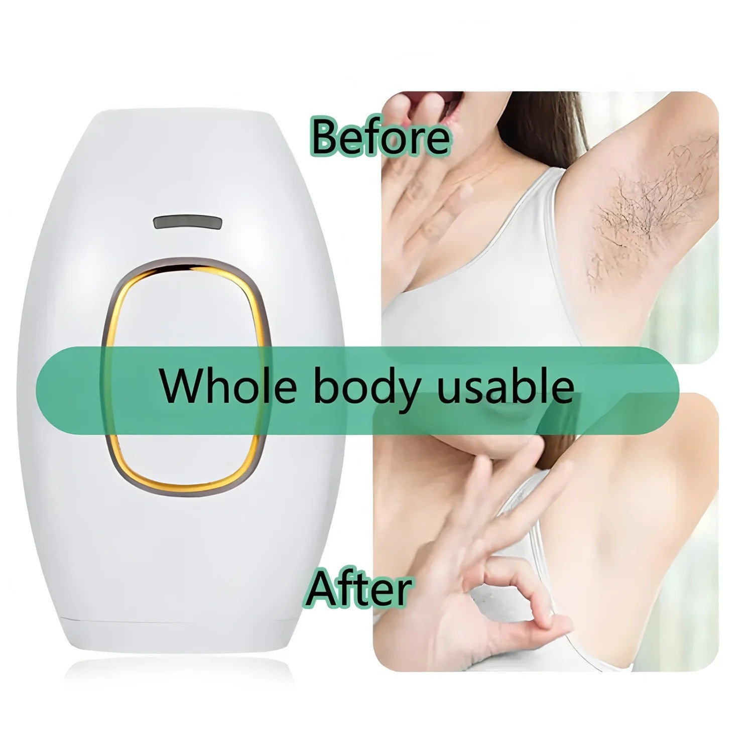 Professional IPL Laser Hair Removal
